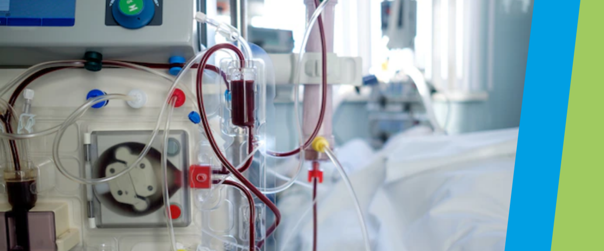 Nueva capacidad terap&eacute;utica: Hemodi&aacute;lisis pedi&aacute;trica en nuestro Hospital