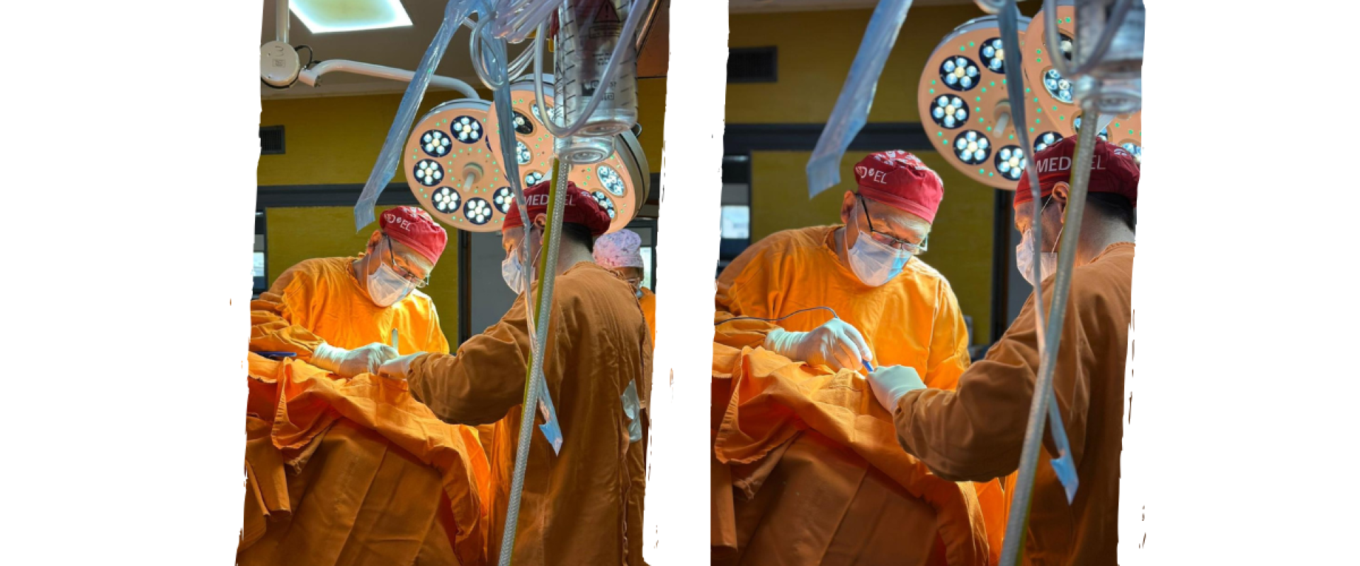 ORL: Primera cirug&iacute;a de implante bonebridge como equipo certificado MEDEL